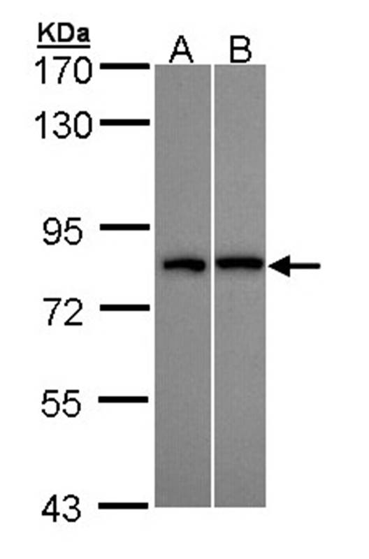 DDX3Y antibody