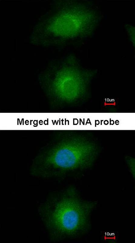MVD antibody
