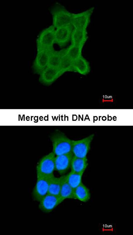 Cartilage-associated protein antibody