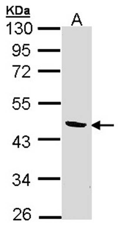 BCAT2 antibody