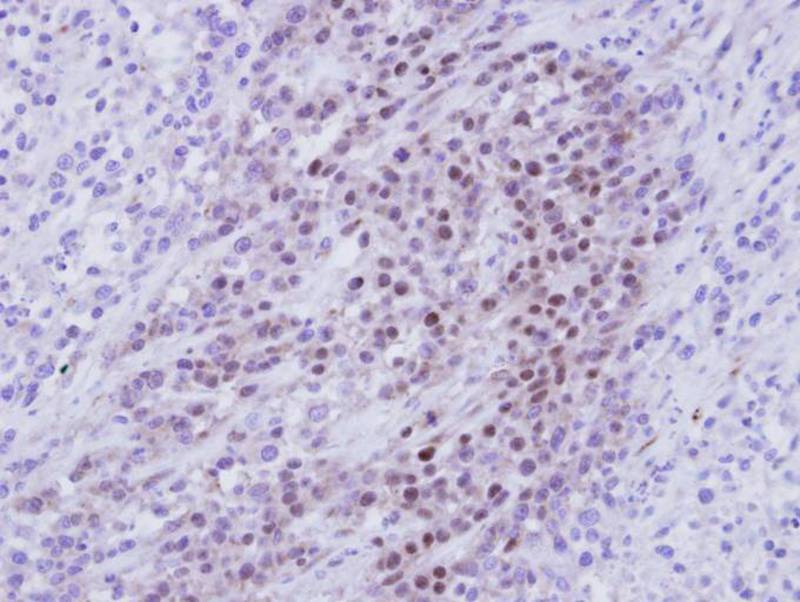 RBMY1A1 antibody