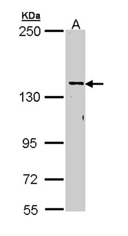 CYFIP2 antibody