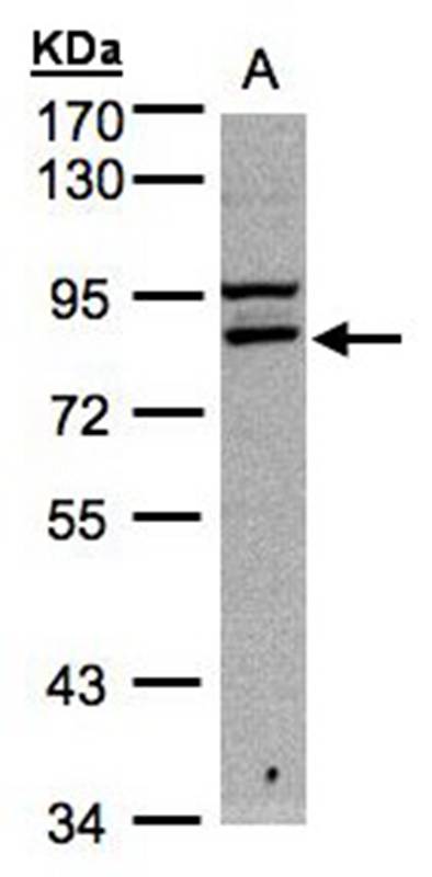 FASTKD1 antibody