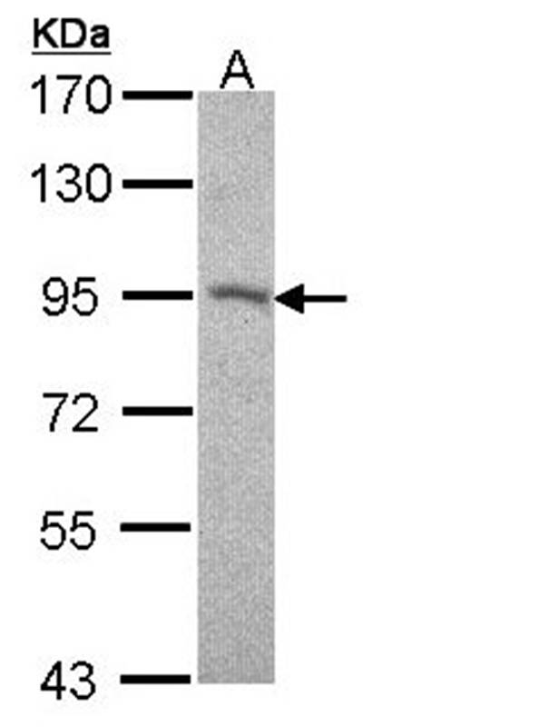 Desmocollin 2 antibody