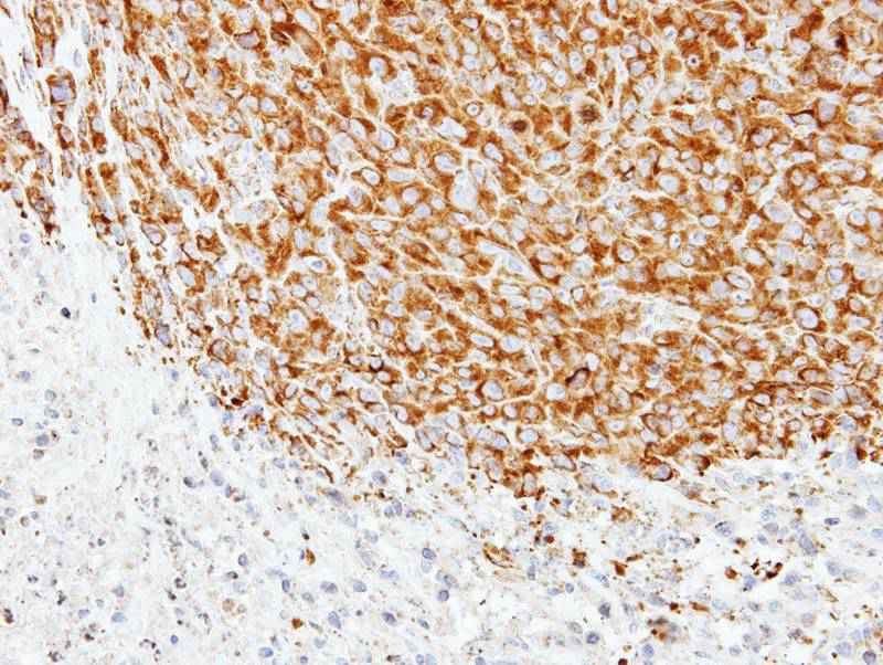 Tubulin alpha 1A antibody