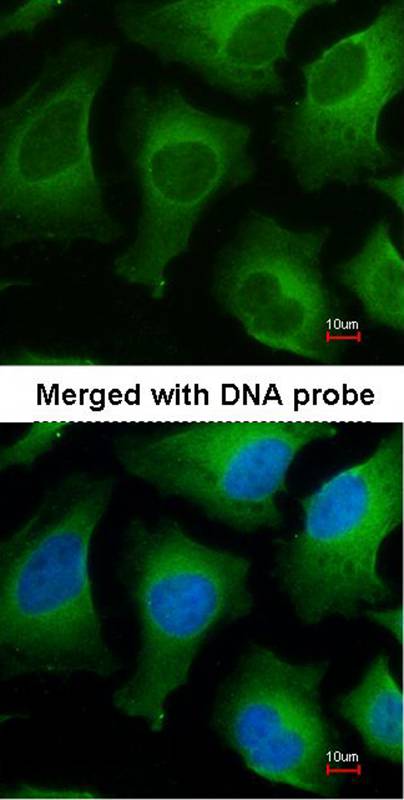 APRT antibody