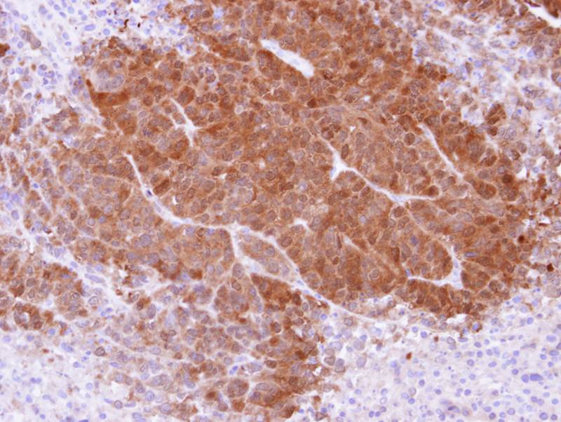 APRT antibody