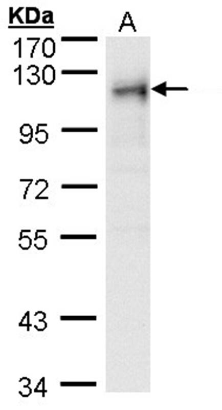 ribosome binding protein 1 antibody