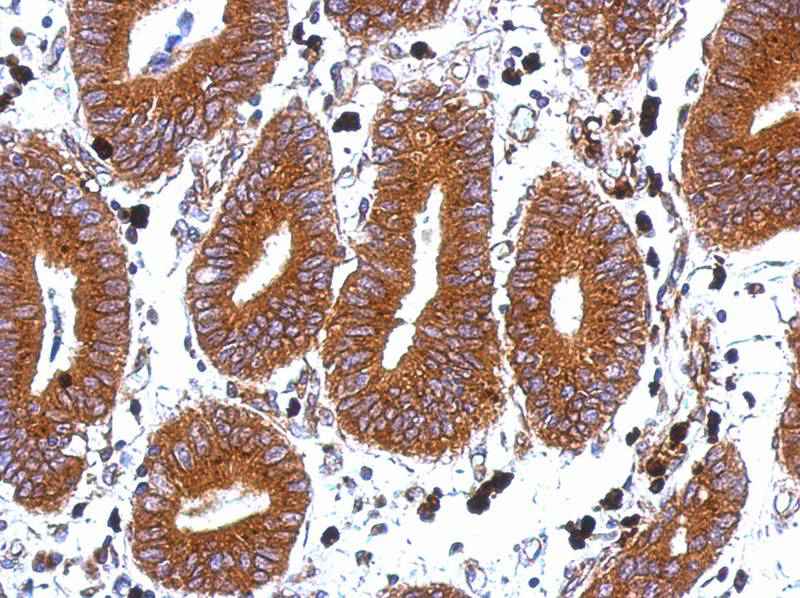 Tetraspan 1 antibody