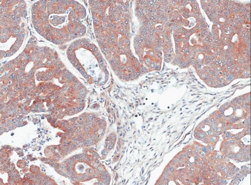 MPI antibody