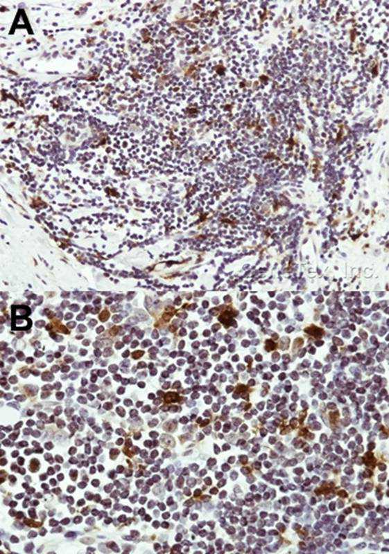 HICE1 antibody