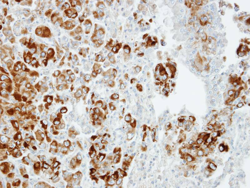Importin 13 antibody