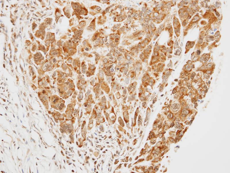 TRIM37 antibody