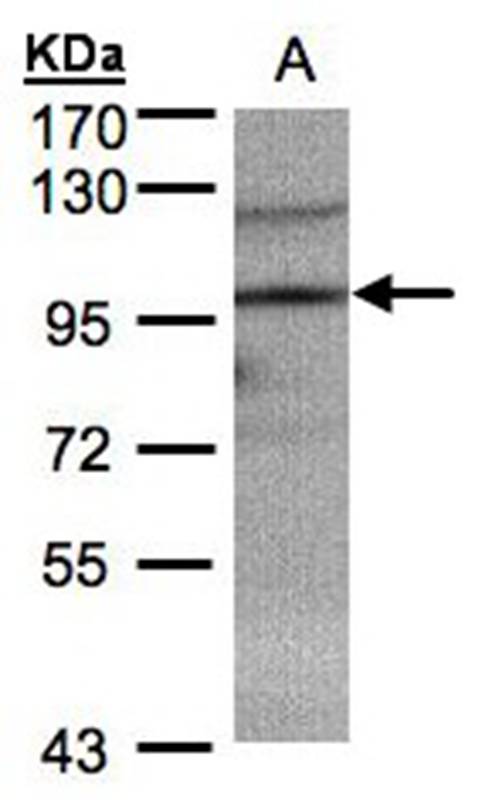 TRIM37 antibody - SAB | Signalway Antibody
