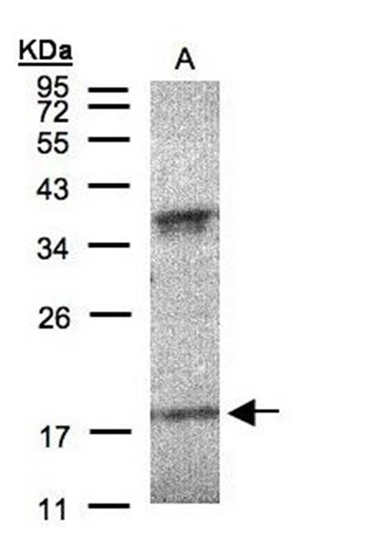 Interferon alpha-6 antibody