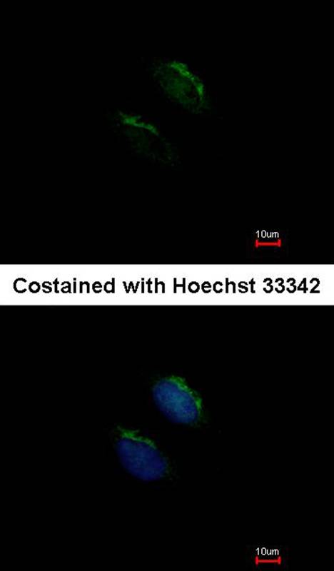 GnT-III antibody