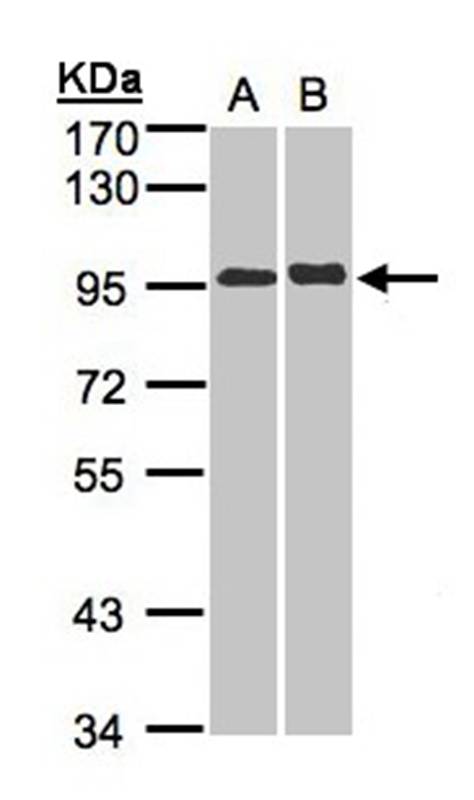 IL-12 Receptor beta2 antibody