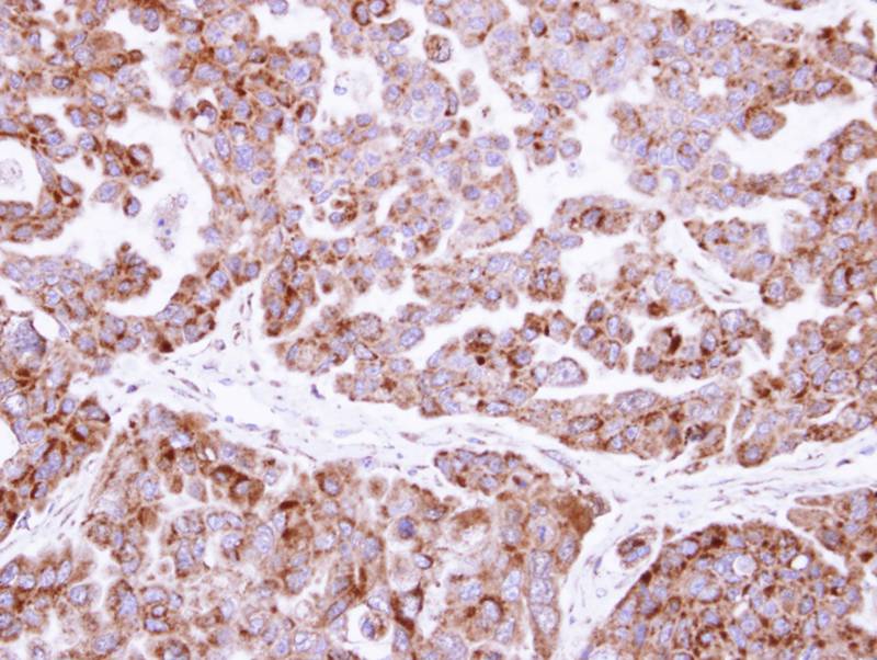 fumarate hydratase antibody