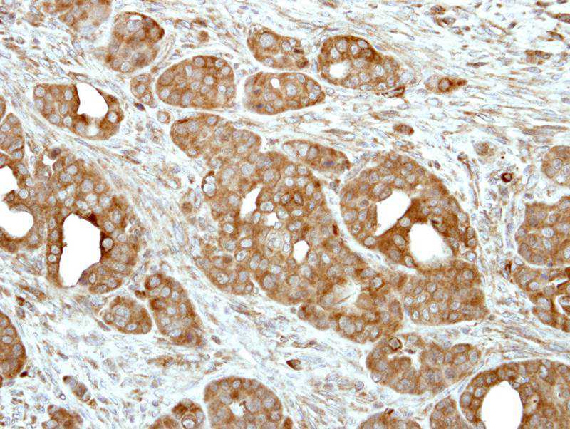 V-ATPase H antibody