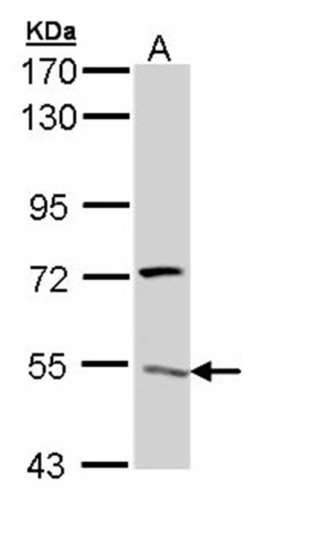 V-ATPase H antibody