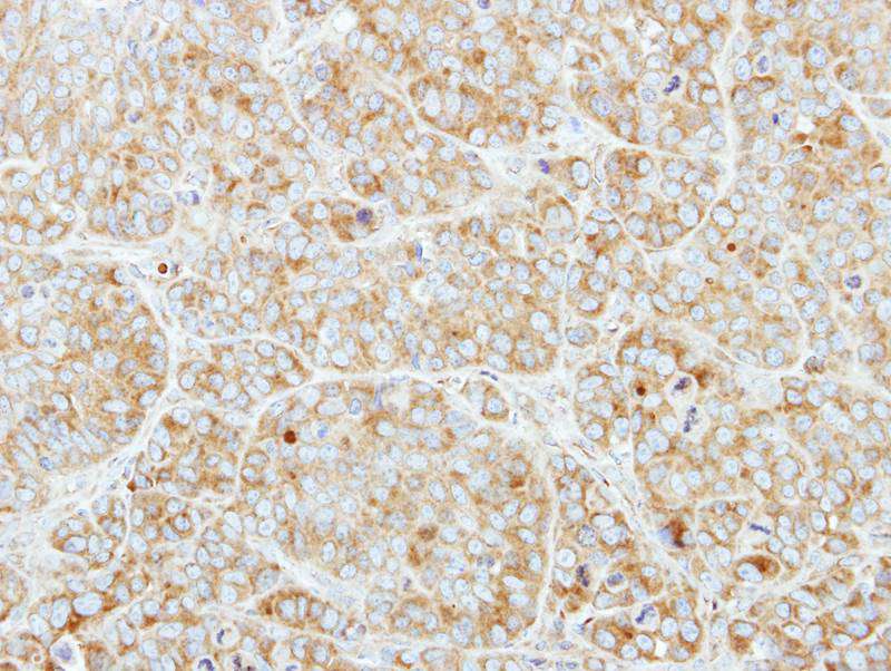CSDE1 antibody