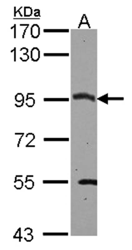 CSDE1 antibody