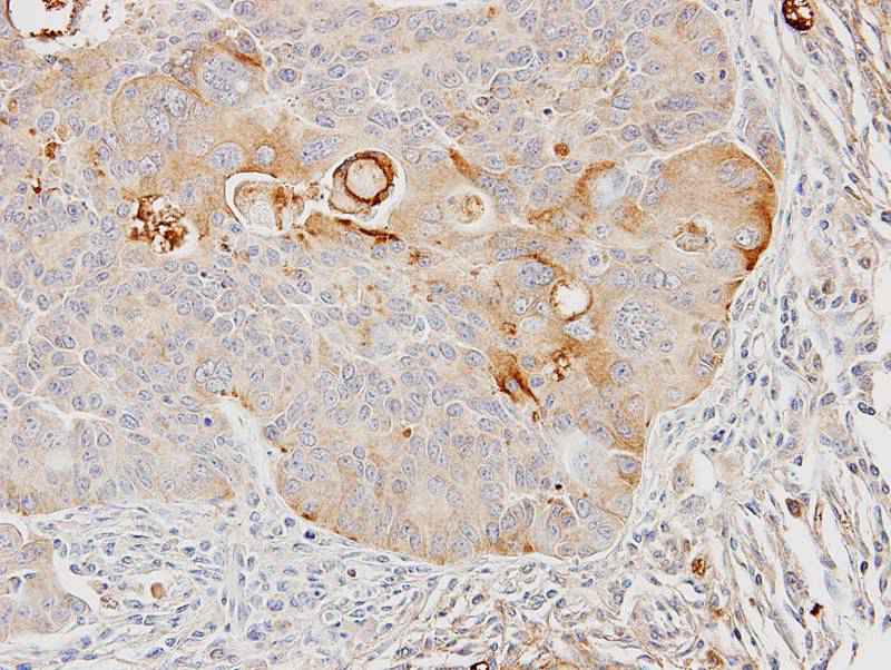 GST A4 antibody
