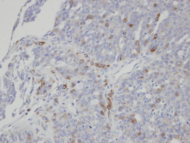 ST3GAL1 antibody