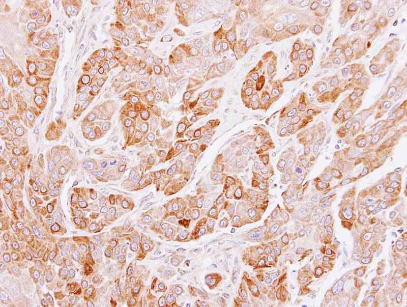 Peflin antibody
