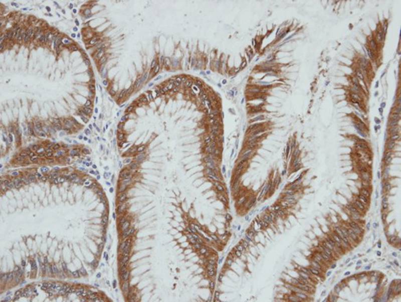 HSD3a antibody