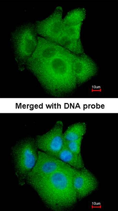 PSAT1 antibody