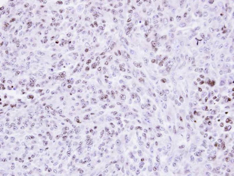 ZNF707 antibody