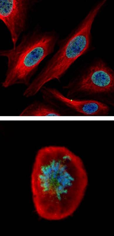CDCA1 antibody