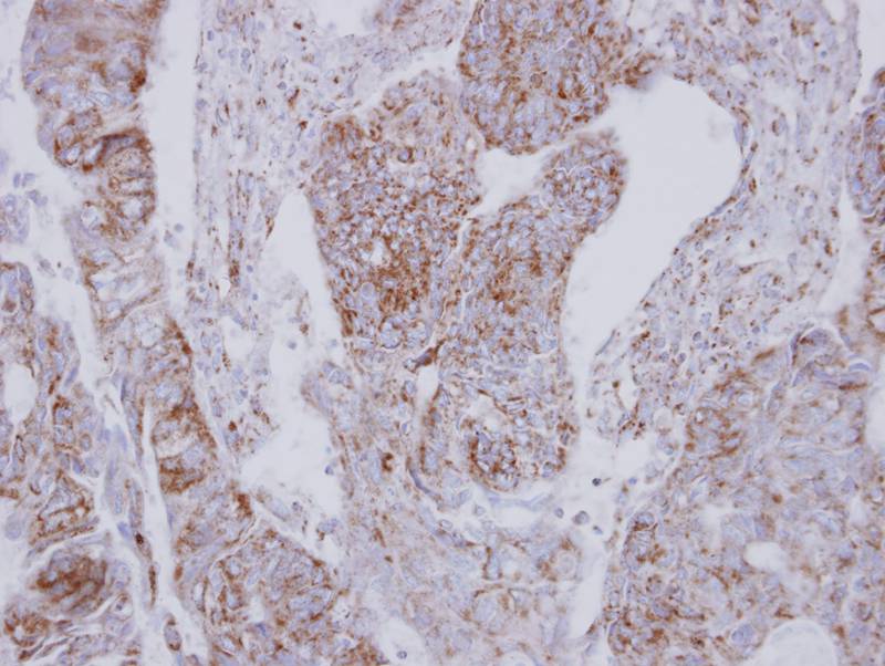 NDUFS2 antibody