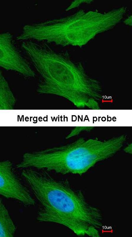 TUBB1 antibody