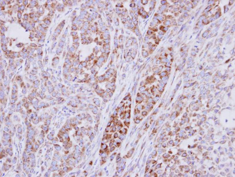 ribosomal protein S10 antibody