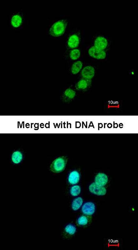 RASAL1 antibody