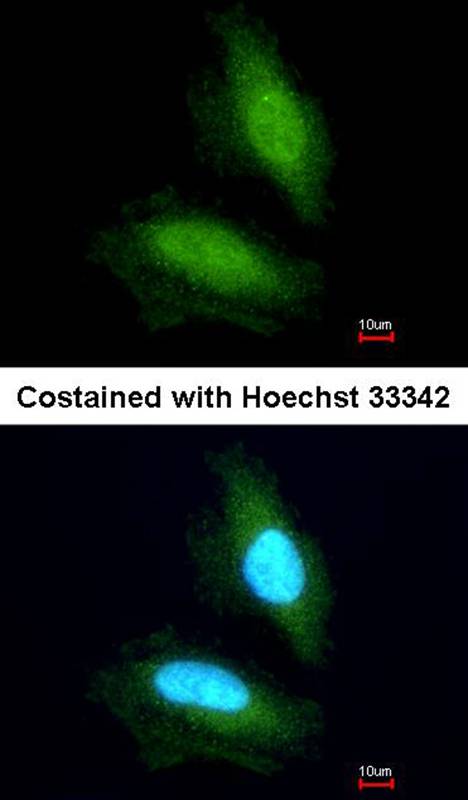 NPEPPS antibody