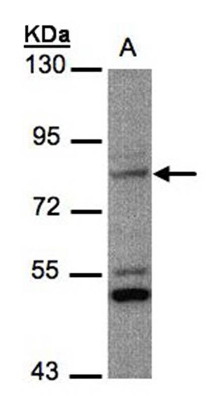 PHEX antibody