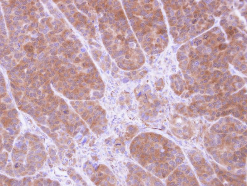 Tropomyosin 2 antibody