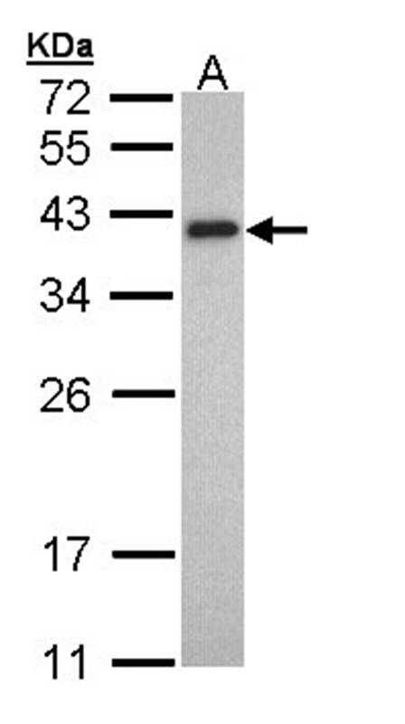 Tropomyosin 2 antibody