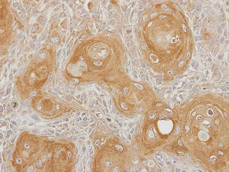 Type II 5-phosphatase antibody