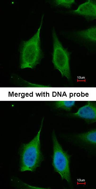 PPA1 antibody