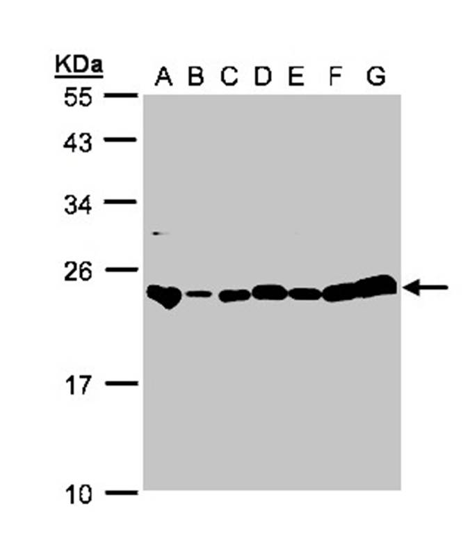 glyoxalase I antibody