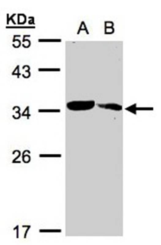 MMACHC antibody