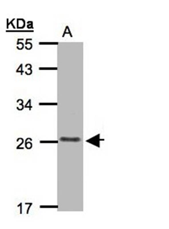 CKLFSF5 antibody