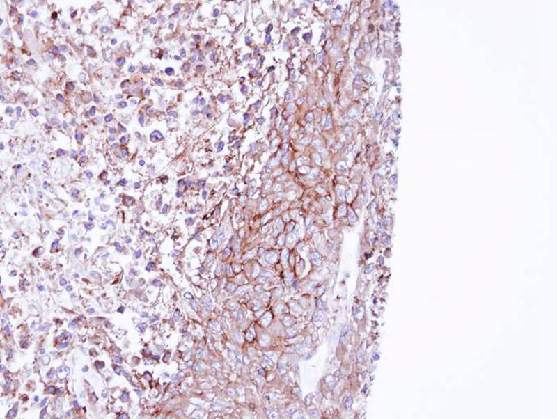 MPP1 antibody