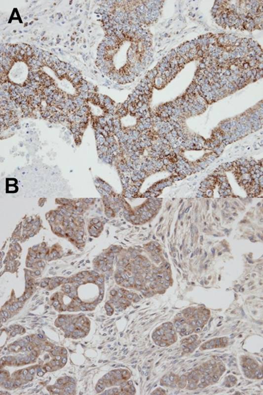 Rab 2 antibody