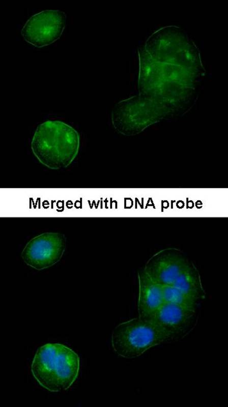 Thrombomodulin(CD141) antibody