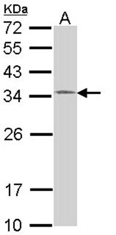 HUS1 antibody